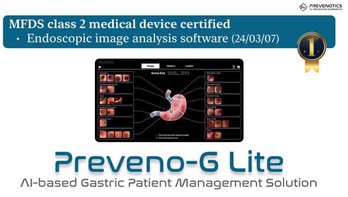 画像解析AIベースの胃内視鏡診断補助ソリューション